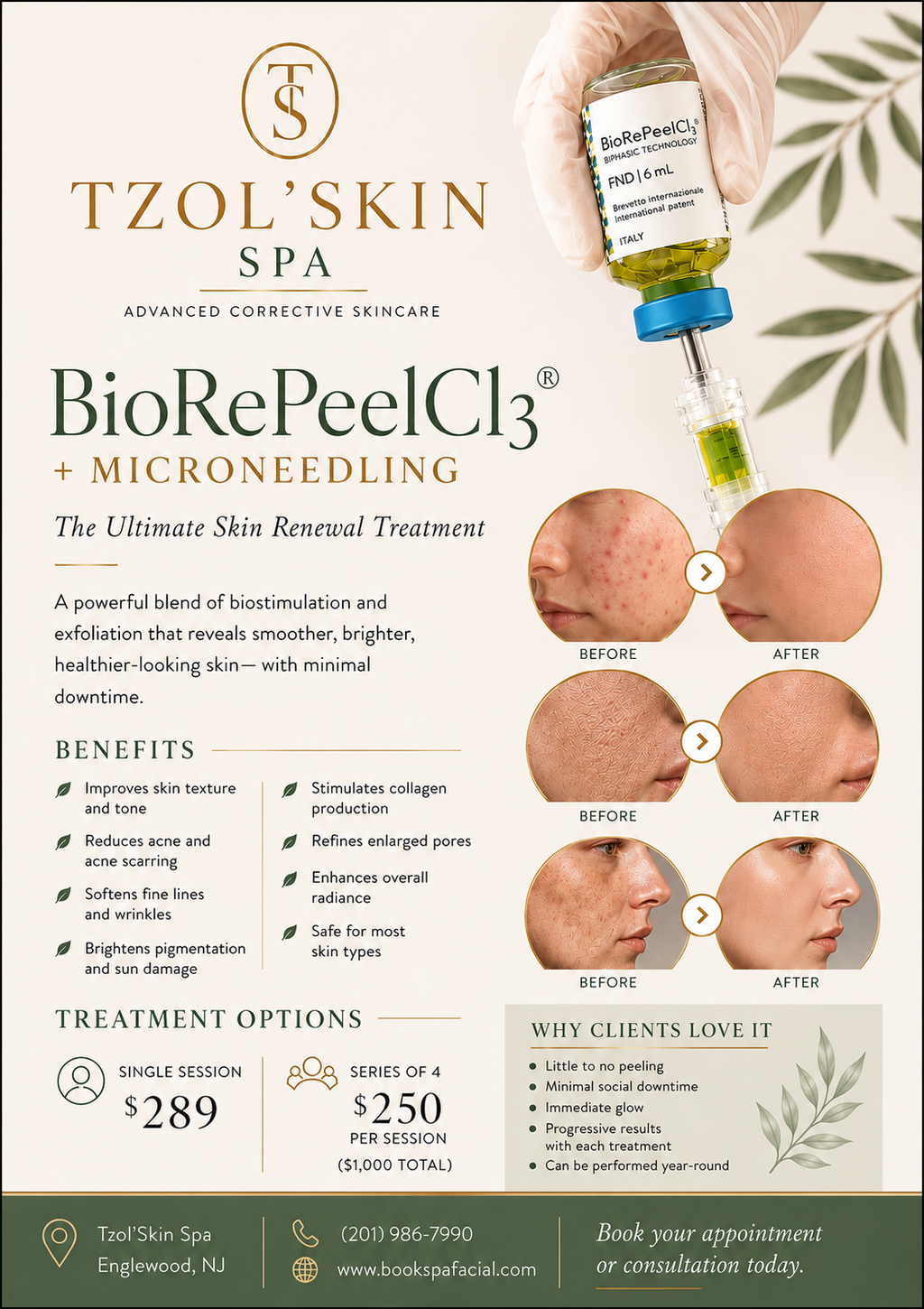 Micro-needling + BioRePeel Facial