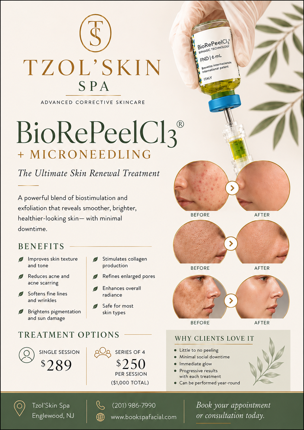 Micro-needling + BioRePeel Facial