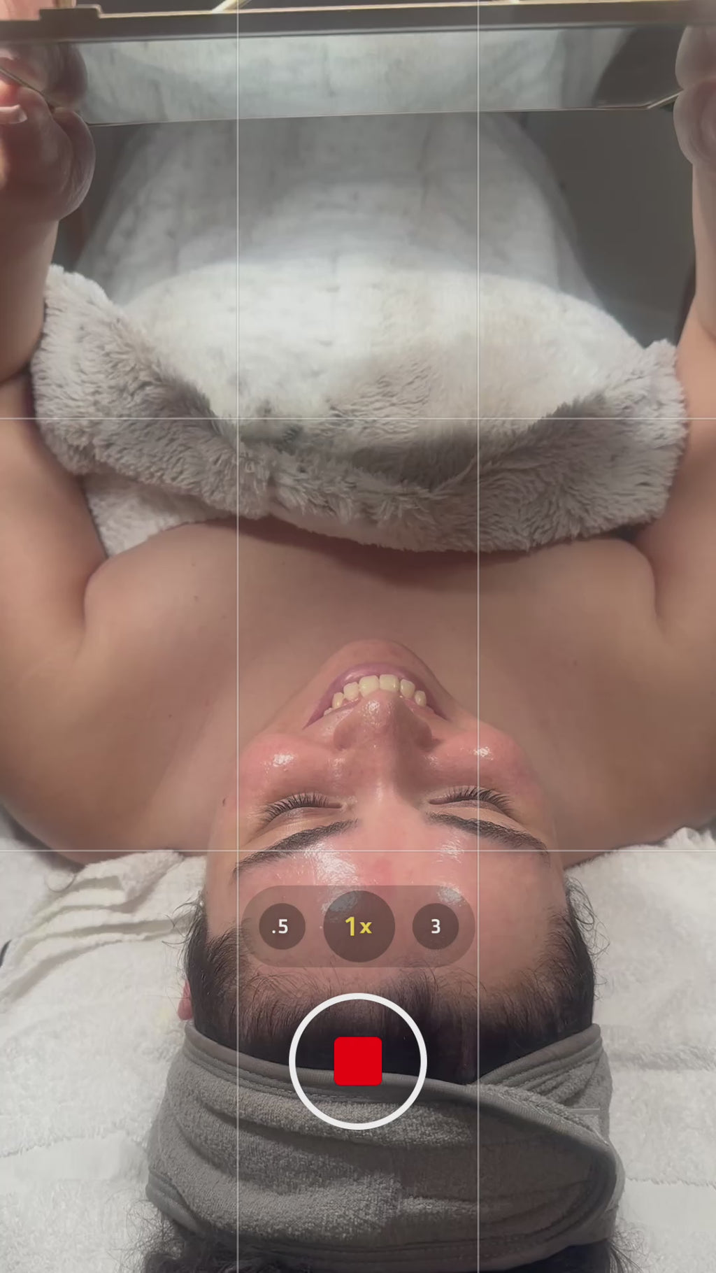 Micro-needling + BioRePeel Facial